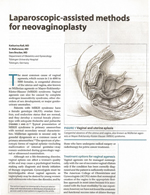 Neovaginoplasty